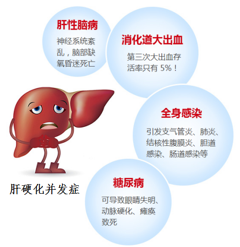 PHGF软肝术_推动医学界肝硬化治疗技术的向前发展！