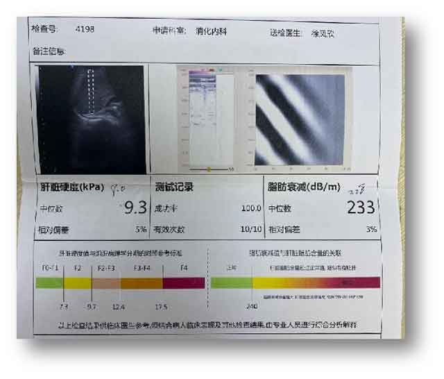 看乙肝大三阳到郑州哪家医院好?郑州有几个乙肝医院