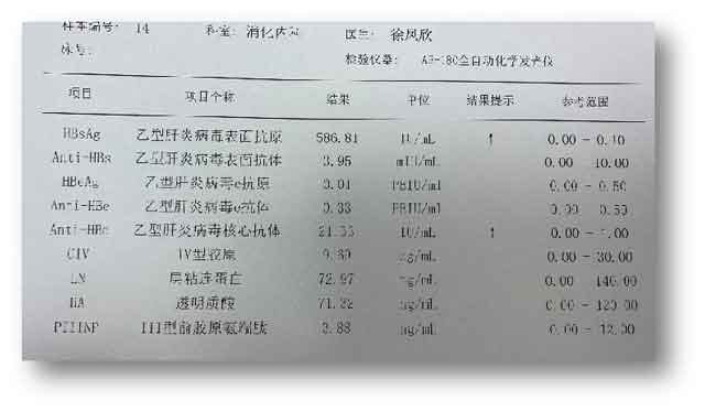 看乙肝大三阳到郑州哪家医院好?郑州有几个乙肝医院