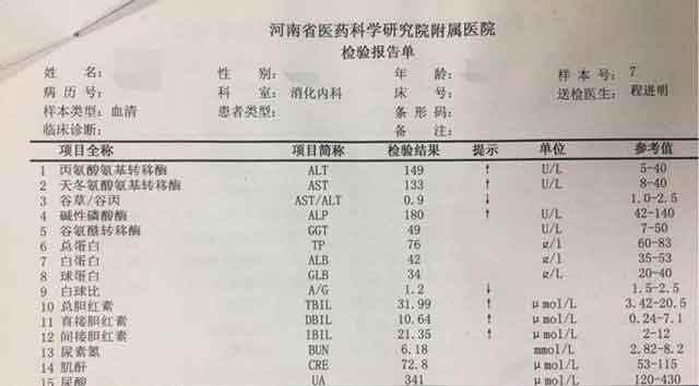 郑州哪儿治疗肝硬化专业?郑州治疗好的肝硬化医院