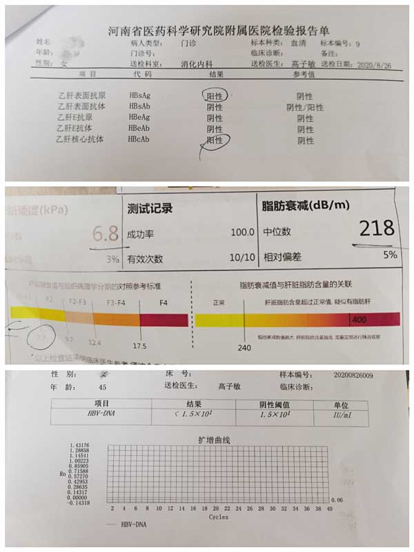 河南省郑州市治疗乙肝的医院排名