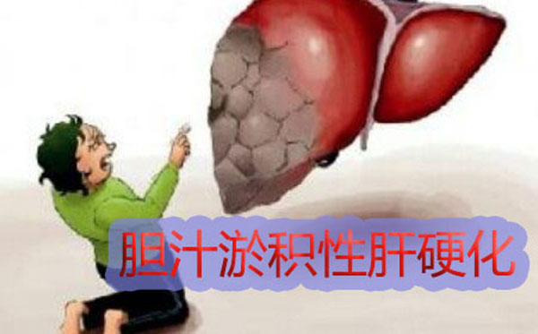郑州肝硬化看的好的医院哪家好